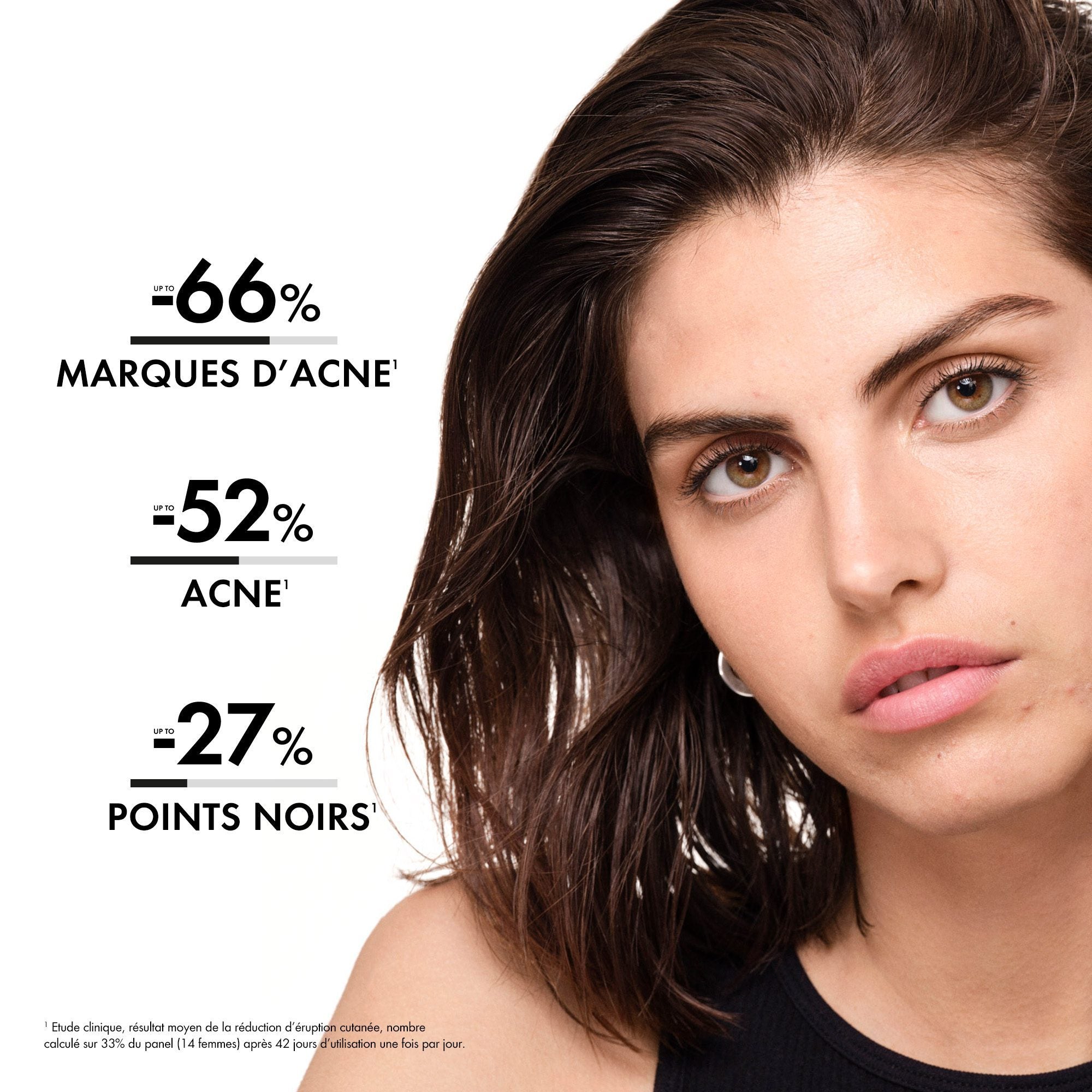 Vichy Normaderm Sérum Anti-Imperfections PROBIO-BHA. Peau Grasse Acnéique | 30ml