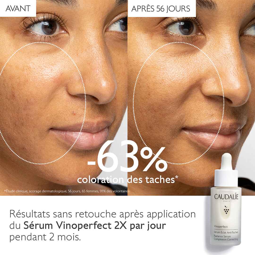 CAUDALIE Vinoperfect Sérum Eclat Anti-Taches 30 mL