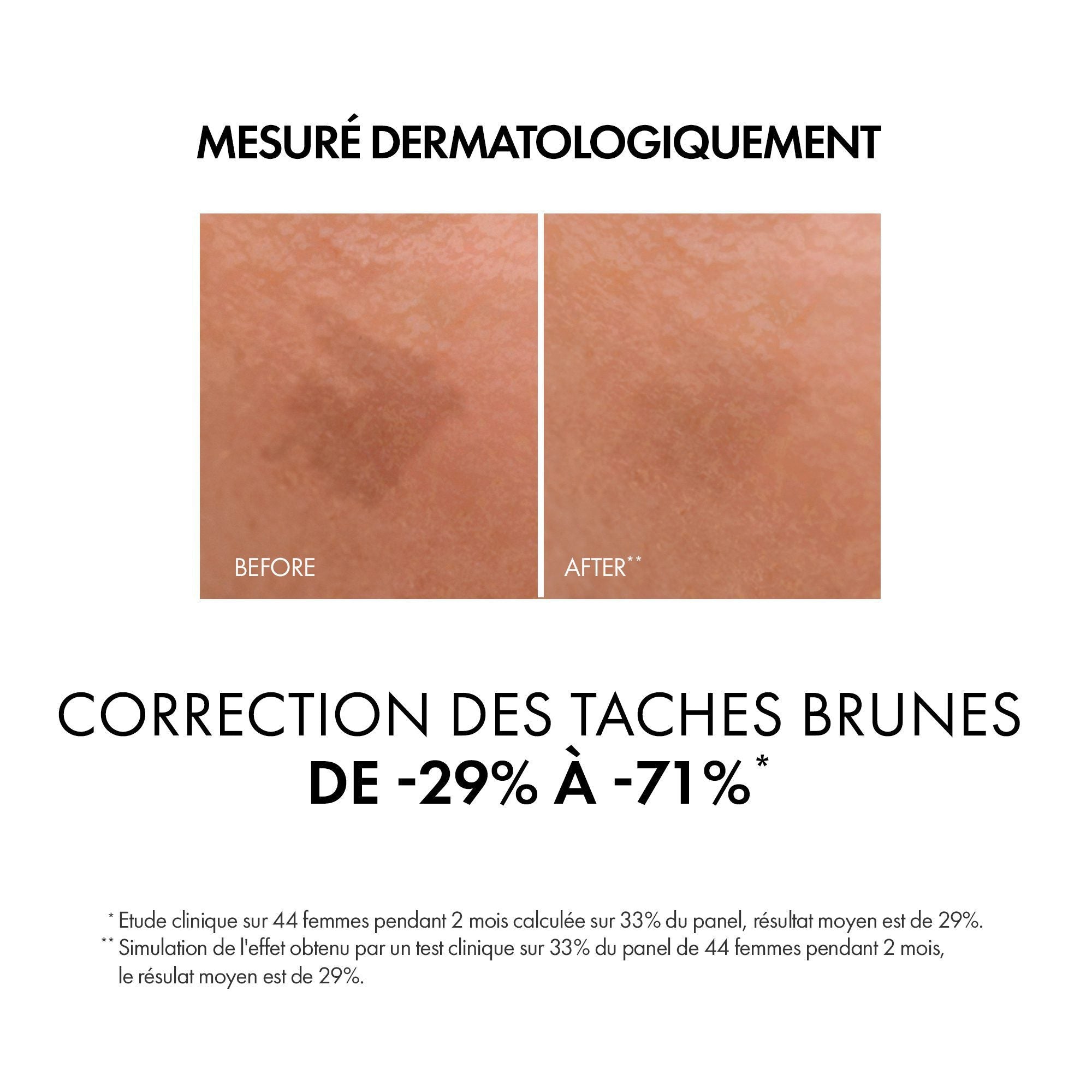 LIFTACTIV SPECIALIST SERUM ANTI-TACHE B3 | Tous types de peaux | 30ml